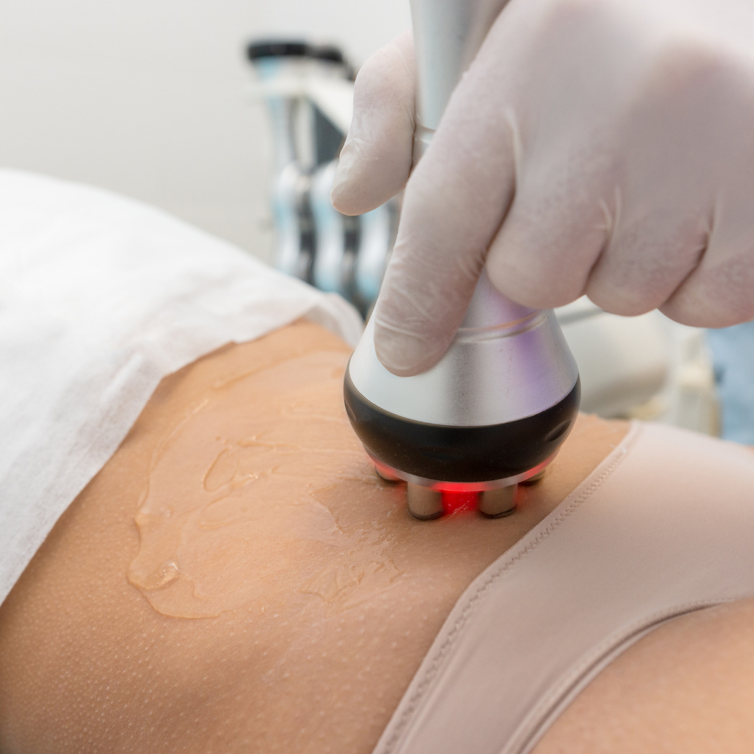 Radio frequency skin tightening body