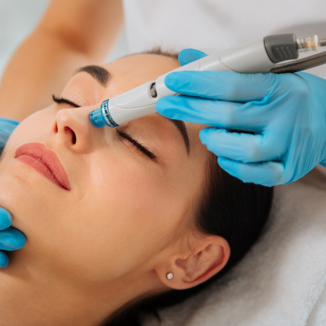 Hydradermabrasion